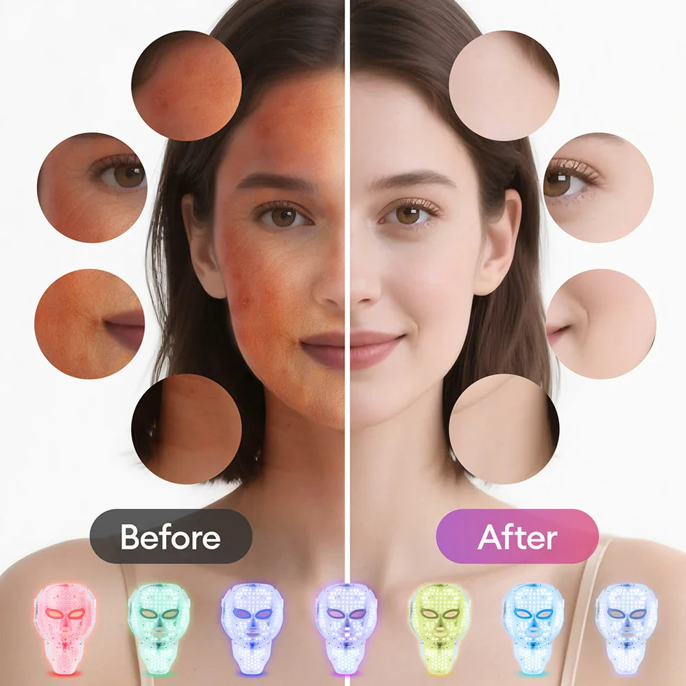 Aura LED Therapy Radiance Mask